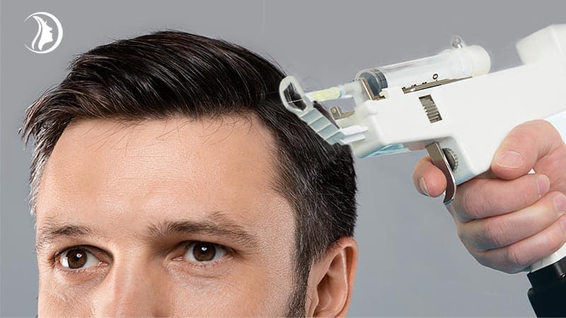 Hair restoration with PRP