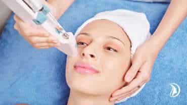 Rejuvenation and lightning of face with PRP
